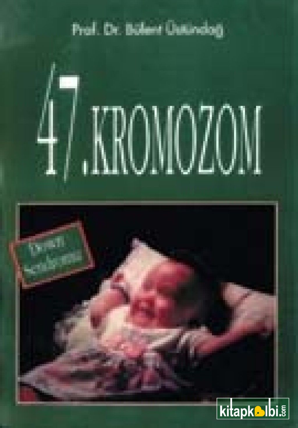 47 Kromozom